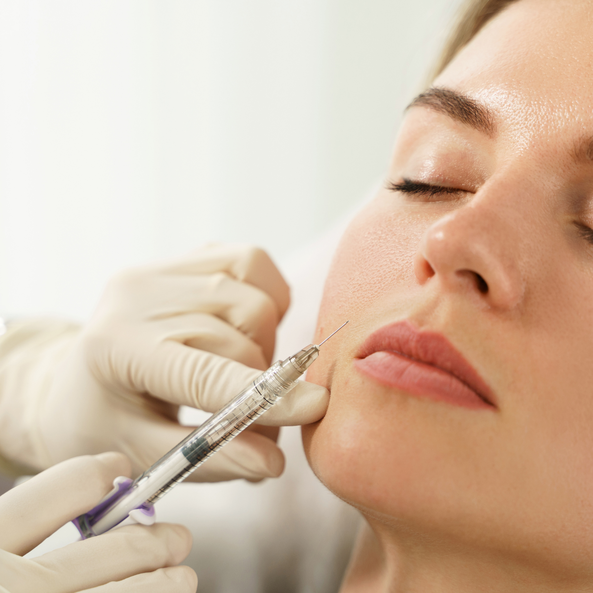 06. Botox Injection Training 3 — Bunny Lines, Flared Nose & Upper Lip Lines
