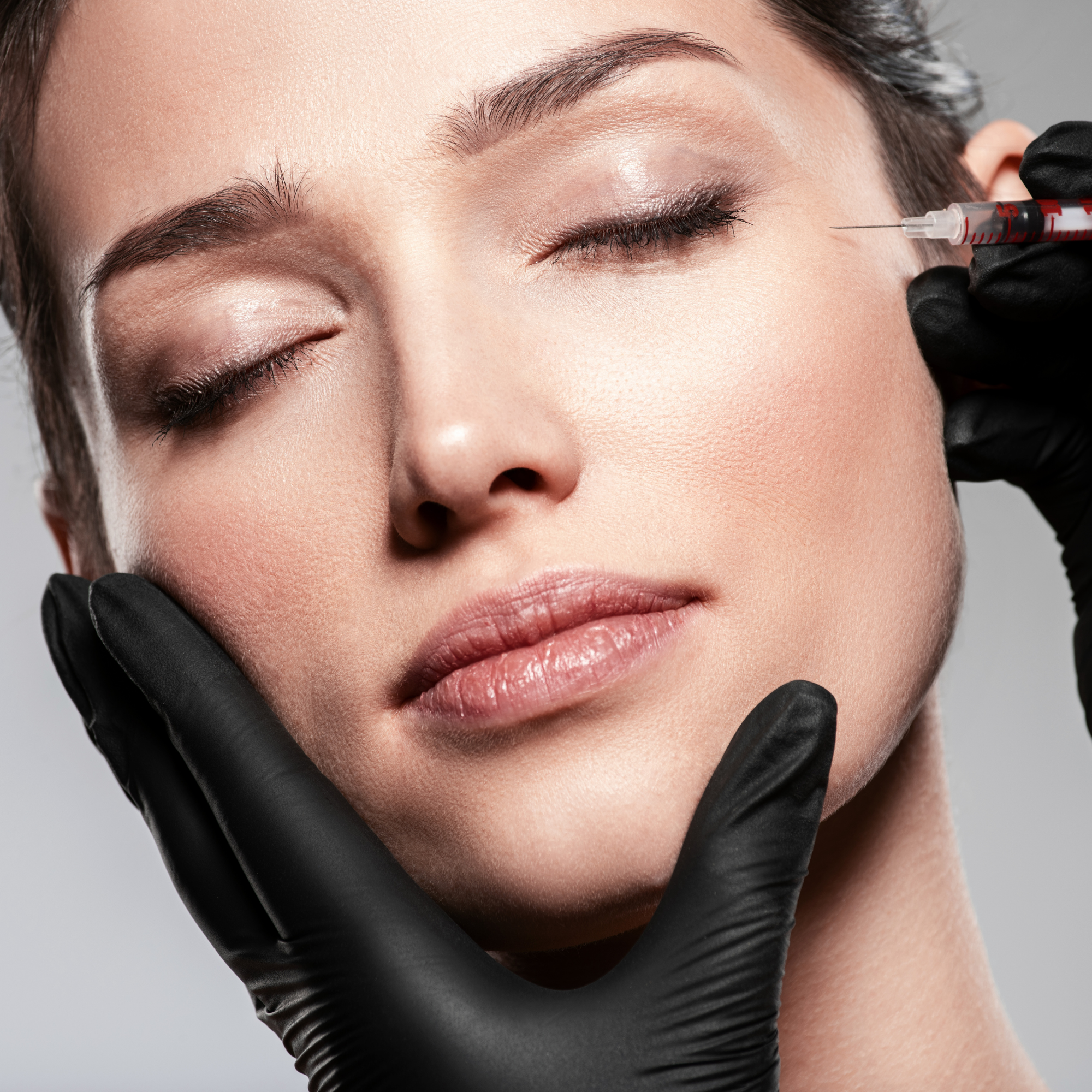 05. Botox Injection Training 2 — Crow’s Feet, Under-Eye & Brow Lift